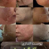 آموزش تخصصی فیشال و پاکسازی|خدمات آموزشی|کرمان, |دیوار