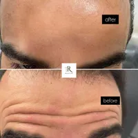 جشنواره ژل و بوتاکس|خدمات آرایشگری و زیبایی|اصفهان, مرداویج|دیوار