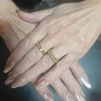 مدل برای ترمیم و کاشت با بیلدر ژل