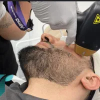 جشنواره سان لیزر برای بهمن ماه|خدمات آرایشگری و زیبایی|تبریز, |دیوار