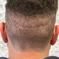 پرپشتی مو در سه روز بدون کاشتمو|خدمات آرایشگری و زیبایی|جهرم, |دیوار