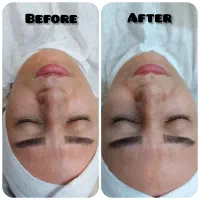 پاکسازی پوست شیراز|خدمات آرایشگری و زیبایی|شیراز, شهرک فرهنگیان|دیوار