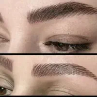 میکروبلیدینگ  تغییررنگ تتوی تیره به روشن ۴۵۰