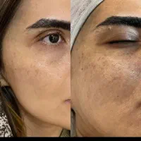 کراتین فقط ۱۵۰۰ با هر قد وحجم مو