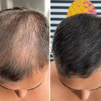 موهات دارن دسته جمعی فرار میکنن