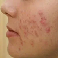 پماد|آرایشی، بهداشتی، درمانی|گرگان, |دیوار