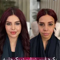 پکیج جوانسازی /کانتور /رفع لاغری صورت/فیلر