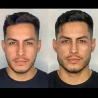 جشنواره ی پاییزه ی فیلر وبوتاکس|خدمات آرایشگری و زیبایی|ارومیه, |دیوار