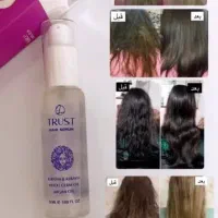 مشاورتخصصی پوست ومو|خدمات آرایشگری و زیبایی|شیراز, دارالرحمه|دیوار