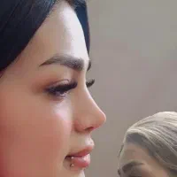 جراحی و زیبایی صورت و بدن|خدمات آرایشگری و زیبایی|سبزوار, مدرس|دیوار