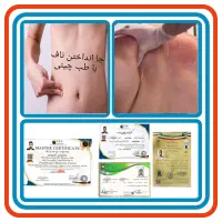 حجامت/بادکش/زالو/ناف گیر/ماساژدرمانی درمنـزل شـما|خدمات آرایشگری و زیبایی|کرمانشاه, |دیوار