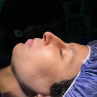 جراحی بینی باتخفیف ویژه جشنواره