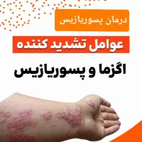 پماد اگزما پسو