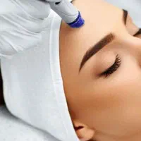 کربن تراپی لیزر کیوسوئیچ بستن منافذ