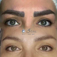 ریموو تتو یک جلسه|خدمات آرایشگری و زیبایی|اصفهان, فرح آباد|دیوار