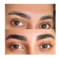 مدل میکروبلیدنیگ و میکروپیگمنتیشن