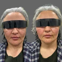 زیبا سازی|خدمات آرایشگری و زیبایی|سقز, |دیوار