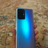شیائومی 11tpro