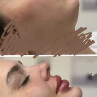 ژللب۱/۲۰۰بوتاکس مصپورت۵۹۹لیزر فول بادی۳۹۹