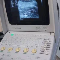 دستگاه سونوگرافی ۵۵۰۰سویی