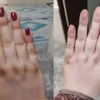 کرم برای سفیدی دست