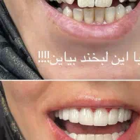 ارائه خدمات  دندانپزشکی با تخفیف ویژه