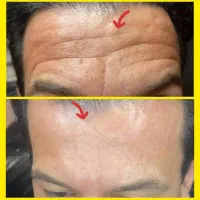 کرم بیوممتیک جوانساز جایگزین بوتاکس