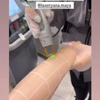 ۳۵۰،۰۰۰ت اعتبارهدیه باشگاه یانا و مایا(لیزر کندلا)|خدمات آرایشگری و زیبایی|شوش, |دیوار