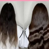 ریزش مو و پوستی