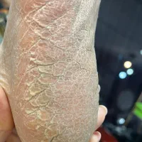 آموزش و خدمات پدیکور تخصصی به سبک روسی|خدمات آرایشگری و زیبایی|خوی, |دیوار