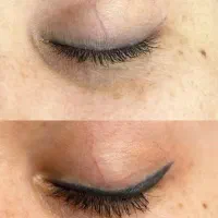 جشنواره‌ تخصصی ریموو تتو با دستگاه فوق‌ پیشرفته|خدمات آرایشگری و زیبایی|دزفول, |دیوار