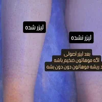 لیزرموی زائد دررودکی فقط بانوان نظارت پزشک ۴۸۰تومن|خدمات آرایشگری و زیبایی|ارومیه, |دیوار