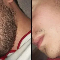 ریش پرپشت بدون کاشت