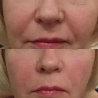 کلینیک تخصصی ژل و فیلر،لیپو و..|خدمات آرایشگری و زیبایی|شهریار, شهریار|دیوار