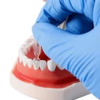 کیت قالب آماده کامپوزیت ueneer دندانپزشکی