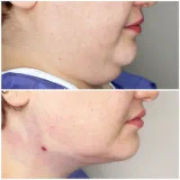 کلینیک تخصصی پوست و مو|خدمات آرایشگری و زیبایی|اهواز, پردیس|دیوار