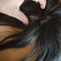 پروتز کف پوستی فرق متحرک|آرایشی، بهداشتی، درمانی|تهران, سردارجنگل|دیوار