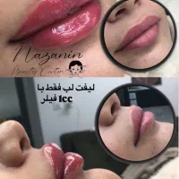 بوتاکس، فیلر و خدمات پیرسینگ|خدمات آرایشگری و زیبایی|رشت, خواهر امام|دیوار