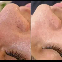 خدمات فیشال حرفه ای|خدمات آرایشگری و زیبایی|زابل, |دیوار