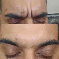 خدمات ژل و بوتاکس بانوان و آقایان|خدمات آرایشگری و زیبایی|پرند, فاز ۵|دیوار