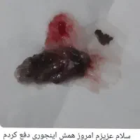 پاکسازی مشکلات رحمی|خدمات آرایشگری و زیبایی|اندیمشک, |دیوار