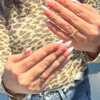 کاشت و ترمیم ناخن