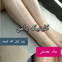 کلینیک یاس /لیزر موهای زائد/رفع انواع تتو|خدمات آرایشگری و زیبایی|اسلام‌شهر, باغ فیض|دیوار