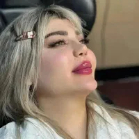 مدل فیلر و بوتاکس (فقط هزینه مواد گرفته میشود)
