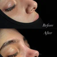 جراحی بینی، پیکر تراشی ترانسفر باسن + شرایط اقساطی|خدمات زیبایی و سلامت|اصفهان, ملکشهر|دیوار