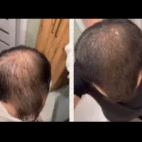 موهات طاس نشده یه فکری به حالش کن
