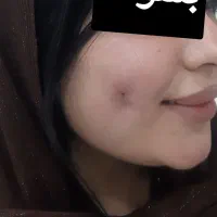 تتو بدن. پیرسینگ.چالگونه .خالبرداری .آموزش کامل