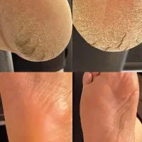 پدیکورتخصصی350آموزش پدیکور پاکسازی دست نوبهار|خدمات آرایشگری و زیبایی|کرمانشاه, |دیوار