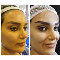 آموزش کاشت ابرو و کات ابرو