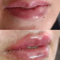 تخفیف ۵۰درصدی بلفارو پلاستی توسط پزشک|خدمات زیبایی و سلامت|کرمانشاه, |دیوار
